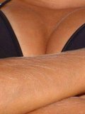 There are several close-up photos of Lori Anderson's amazing long white arm hair