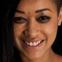 Skin Diamond